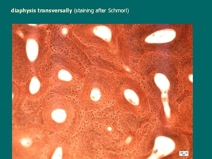 diaphysis transversally (staining after Schmorl) 