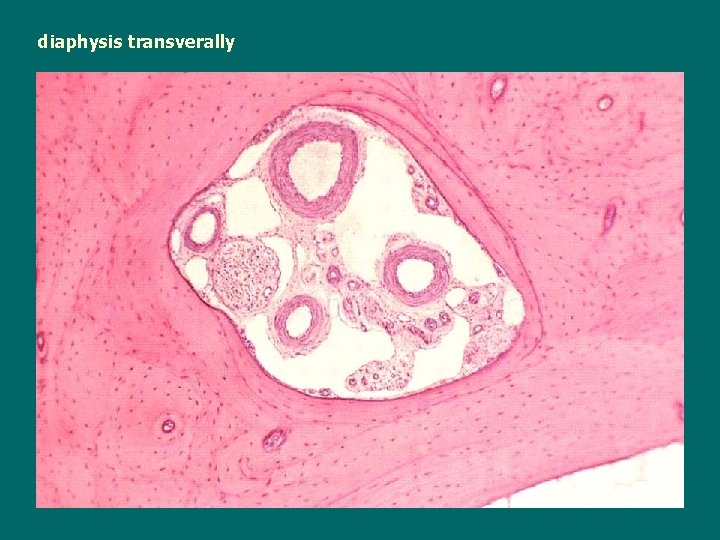 diaphysis transverally 