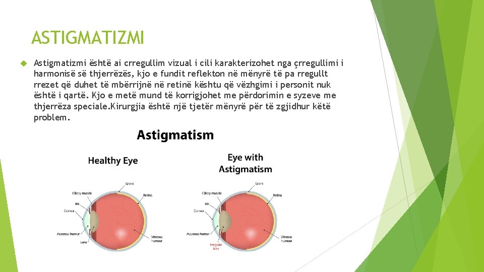 ASTIGMATIZMI Astigmatizmi është ai crregullim vizual i cili karakterizohet nga çrregullimi i harmonisë së