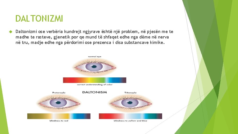 DALTONIZMI Daltonizmi ose verbëria kundrejt ngjyrave është një problem, në pjesën me te madhe