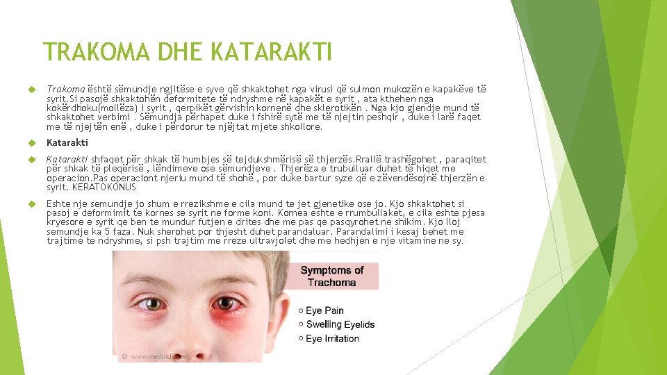 TRAKOMA DHE KATARAKTI Trakoma është sëmundje ngjitëse e syve që shkaktohet nga virusi që