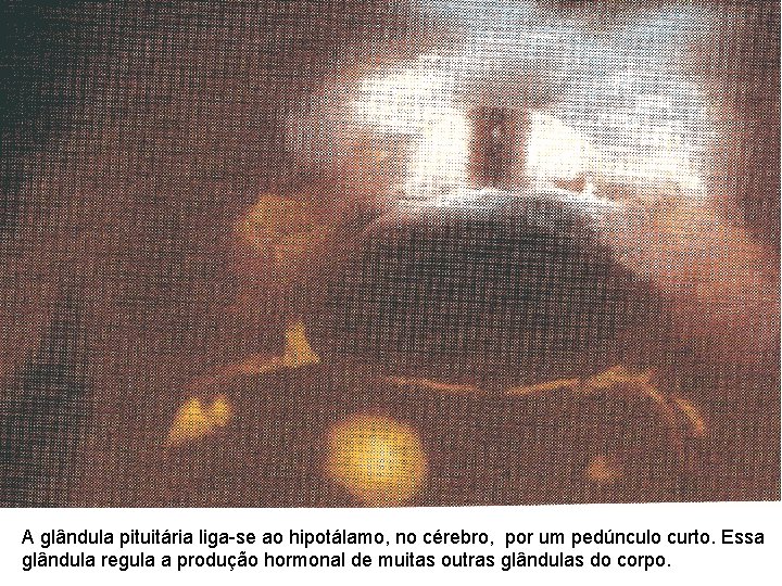 A glândula pituitária liga-se ao hipotálamo, no cérebro, por um pedúnculo curto. Essa glândula A glândula pituitária liga-se ao hipotálamo, no cérebro, por um pedúnculo curto. Essa glândula