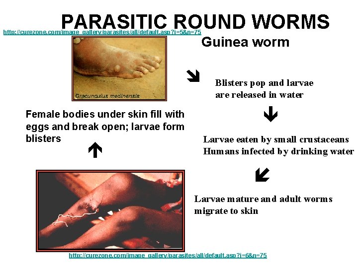 PARASITIC ROUND WORMS http: //curezone. com/image_gallery/parasites/all/default. asp? i=5&n=75 Female bodies under skin fill with