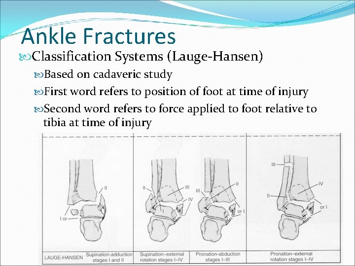 Ankle Fractures Classification Systems (Lauge-Hansen) Based on cadaveric study First word refers to position