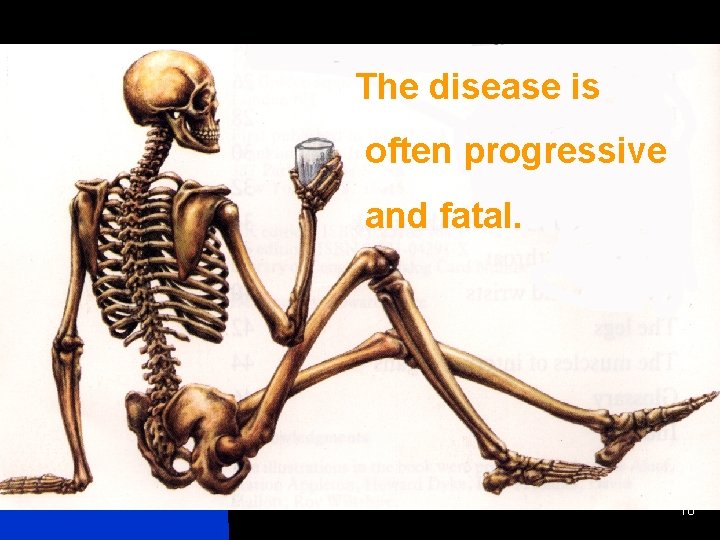 The disease is often progressive and fatal. 10 