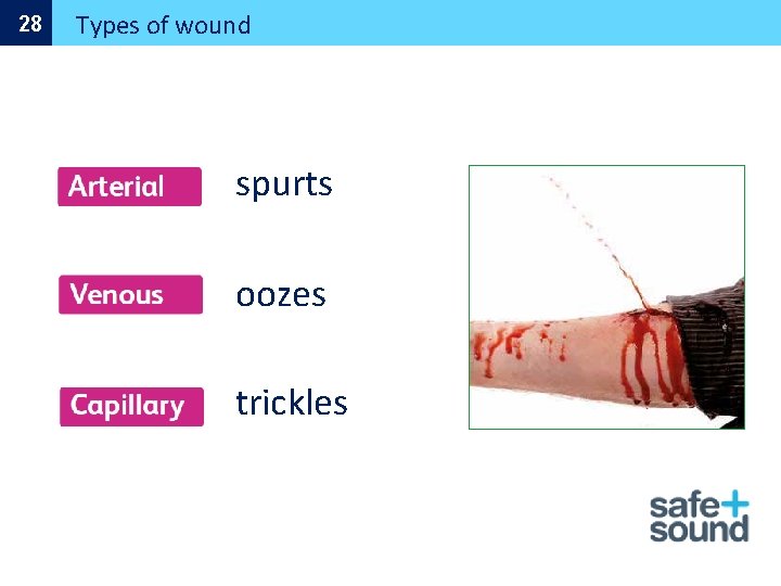 28 Types of wound spurts oozes trickles 