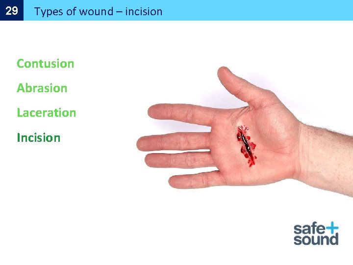 29 Types of wound – incision Contusion Abrasion Laceration Incision 