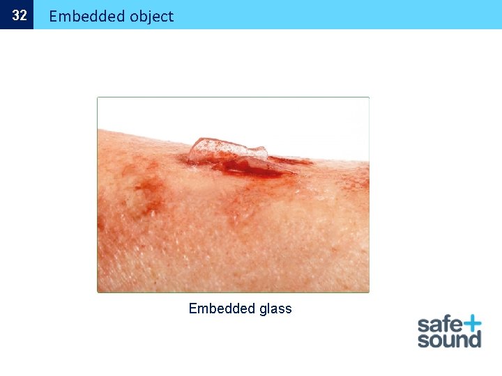 32 Embedded object Embedded glass 