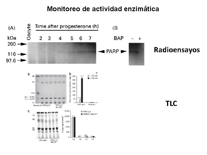 Monitoreo de actividad enzimática Radioensayos TLC 