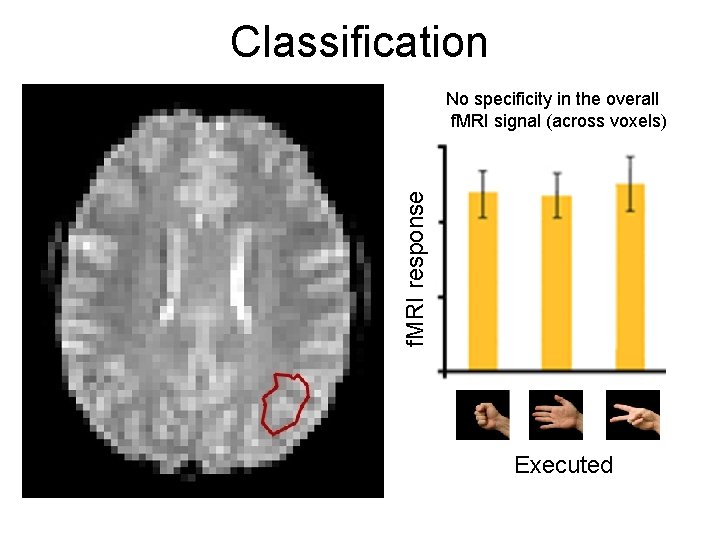 Classification f. MRI response No specificity in the overall f. MRI signal (across voxels)