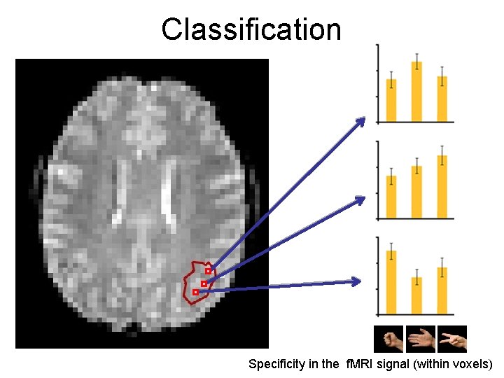 Classification Specificity in the f. MRI signal (within voxels) 
