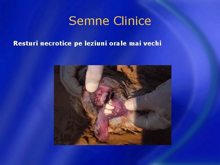 Semne Clinice Resturi necrotice pe leziuni orale mai vechi 