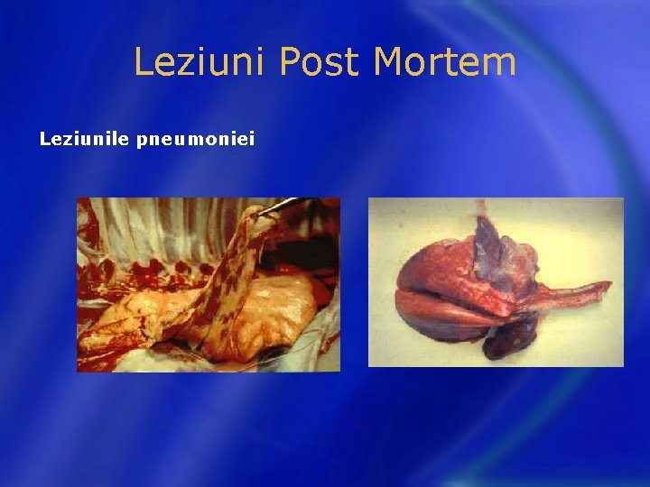 Leziuni Post Mortem Leziunile pneumoniei 