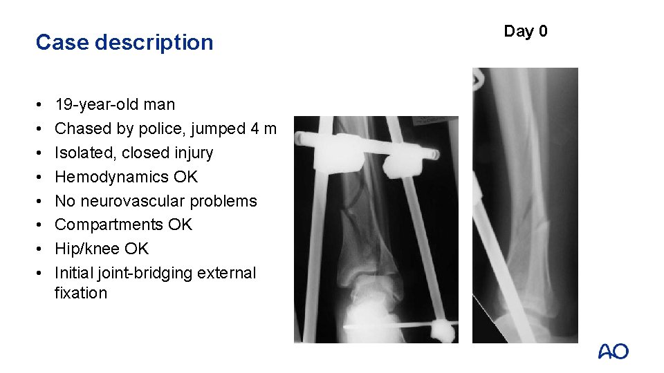 Case description • • 19 -year-old man Chased by police, jumped 4 m Isolated,