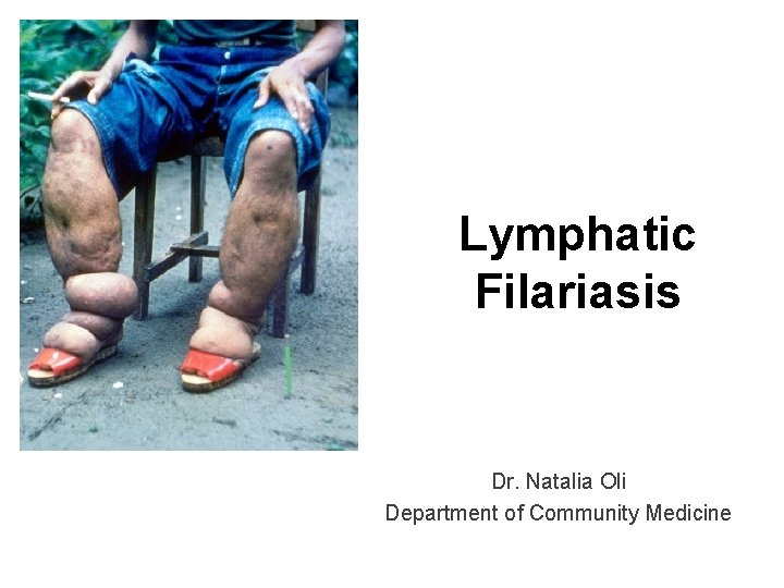 Lymphatic Filariasis Dr. Natalia Oli Department of Community Medicine 