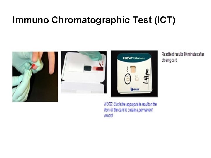 Immuno Chromatographic Test (ICT) 