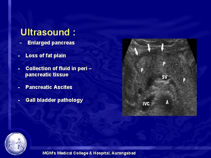  Ultrasound : - Enlarged pancreas - Loss of fat plain - Collection of