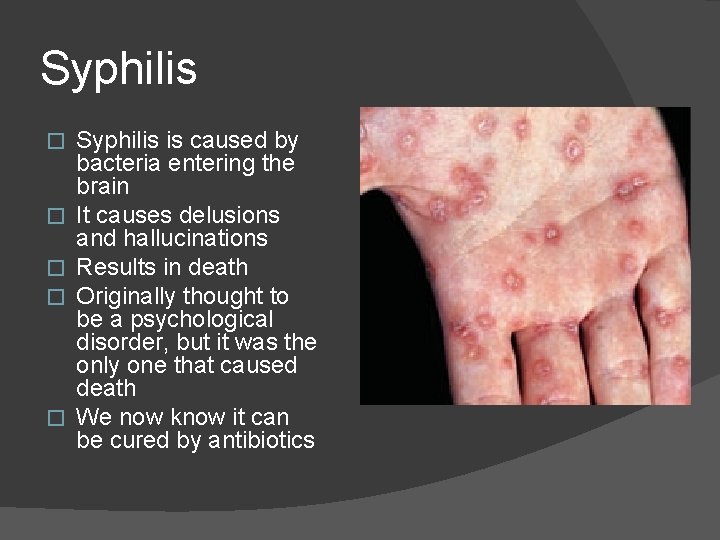 Syphilis � � � Syphilis is caused by bacteria entering the brain It causes