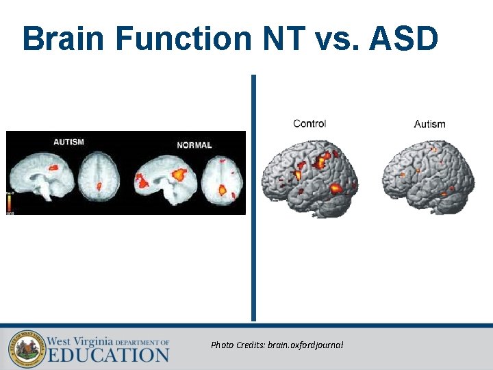 Brain Function NT vs. ASD Photo Credits: brain. oxfordjournal 