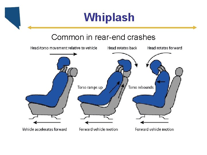 Whiplash Common in rear-end crashes 