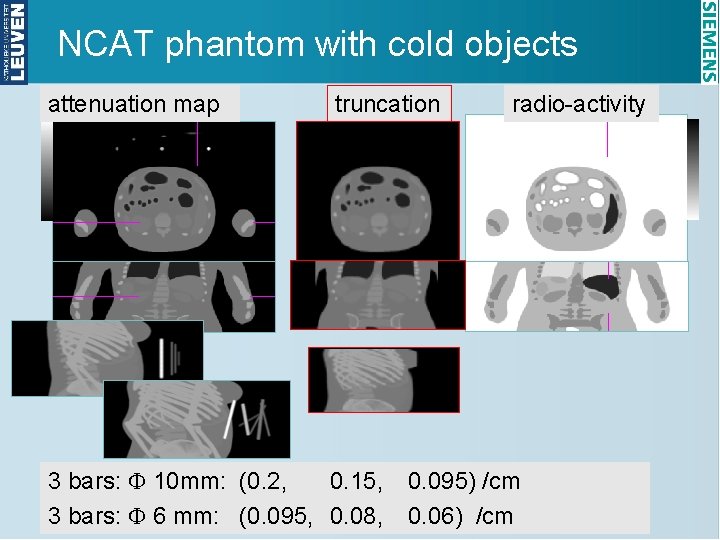 NCAT phantom with cold objects attenuation map truncation 3 bars: F 10 mm: (0.