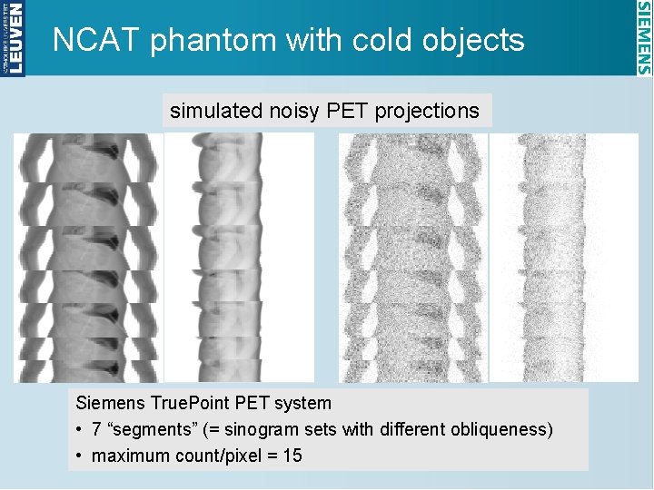 NCAT phantom with cold objects simulated noisy PET projections Siemens True. Point PET system