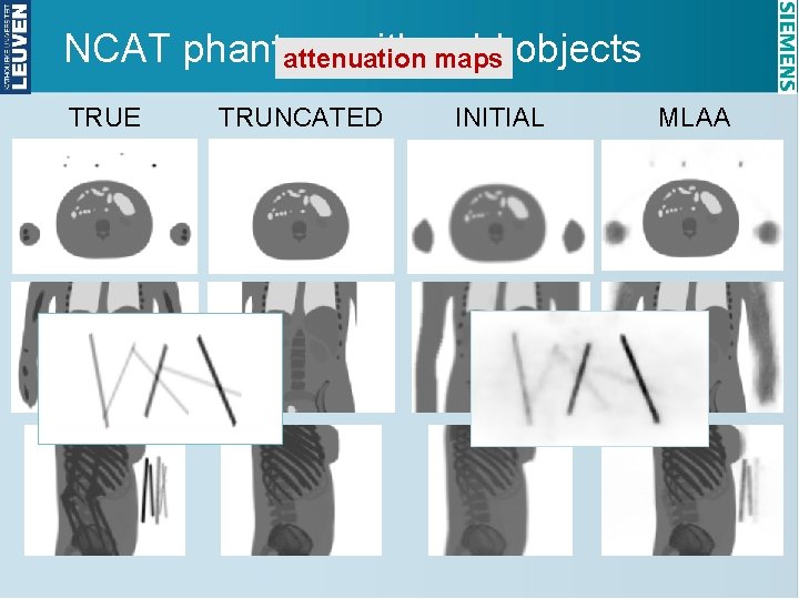 NCAT phantom with cold attenuation maps objects TRUE TRUNCATED INITIAL MLAA 