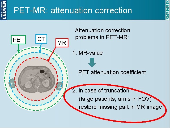 PET-MR: attenuation correction PET CT MR Attenuation correction problems in PET-MR: 1. MR-value PET
