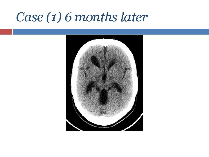 Case (1) 6 months later 