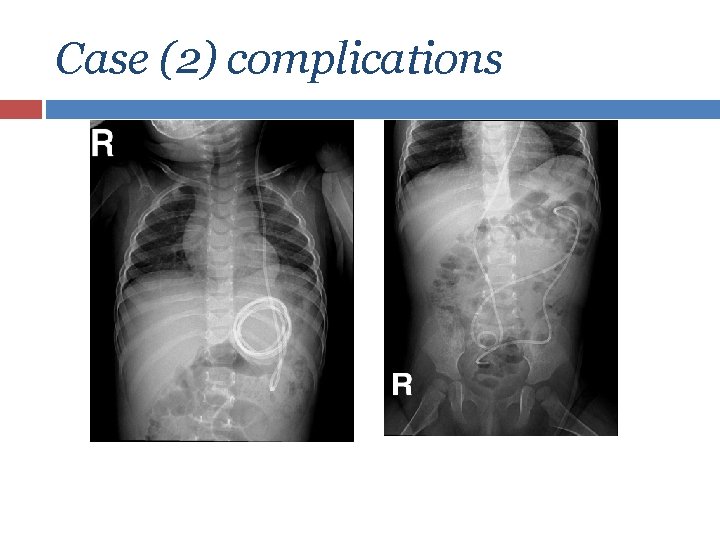 Case (2) complications 