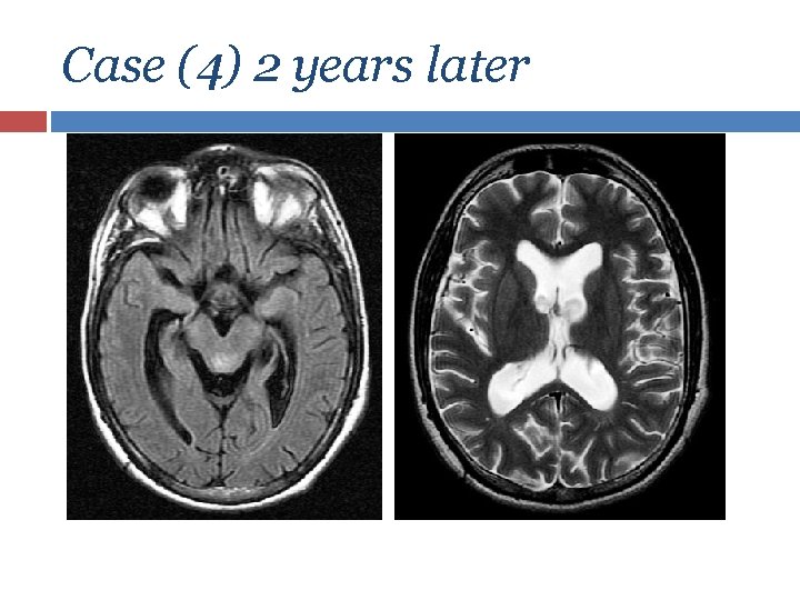 Case (4) 2 years later 