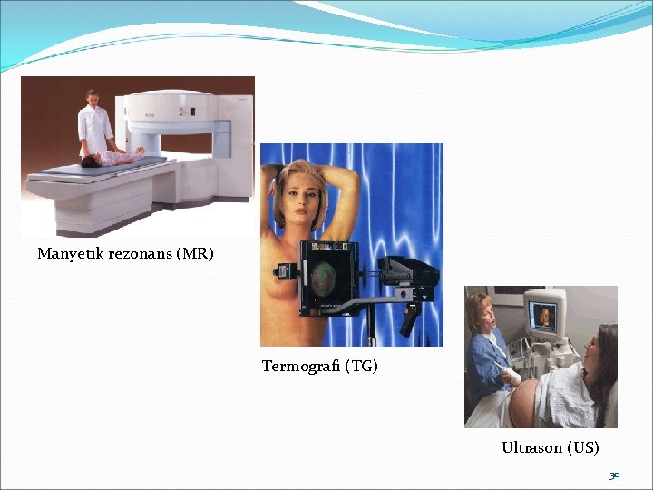 Manyetik rezonans (MR) Termografi (TG) Ultrason (US) 30 