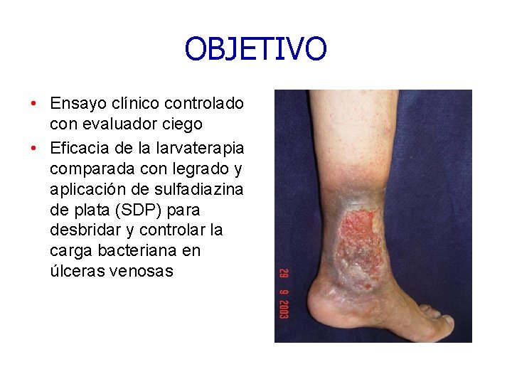 OBJETIVO • Ensayo clínico controlado con evaluador ciego • Eficacia de la larvaterapia comparada