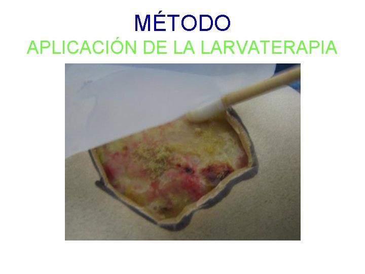 MÉTODO APLICACIÓN DE LA LARVATERAPIA 