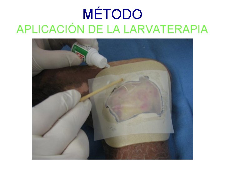MÉTODO APLICACIÓN DE LA LARVATERAPIA 
