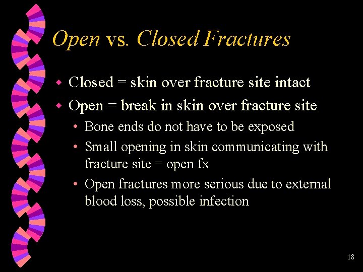 Open vs. Closed Fractures Closed = skin over fracture site intact w Open =