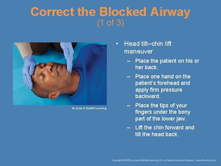 Correct the Blocked Airway (1 of 3) • Head tilt–chin lift maneuver – Place