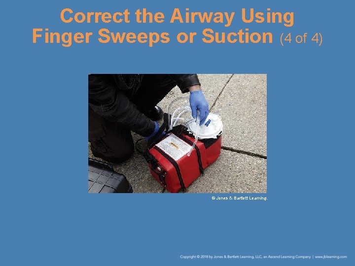 Correct the Airway Using Finger Sweeps or Suction (4 of 4) © Jones &