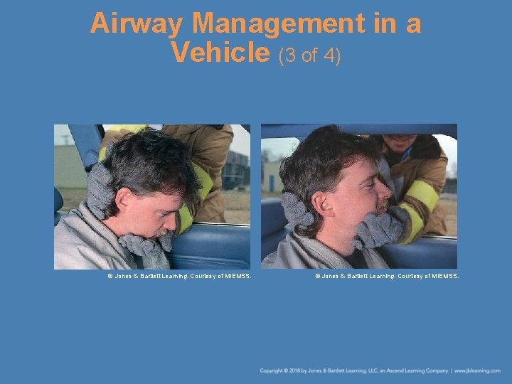 Airway Management in a Vehicle (3 of 4) © Jones & Bartlett Learning. Courtesy