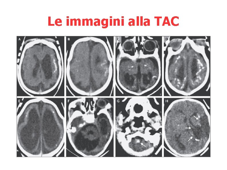 Le immagini alla TAC 