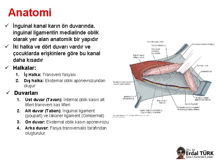 Anatomi ü İnguinal karın ön duvarında, inguinal ligamentin medialinde oblik olarak yer alan anatomik