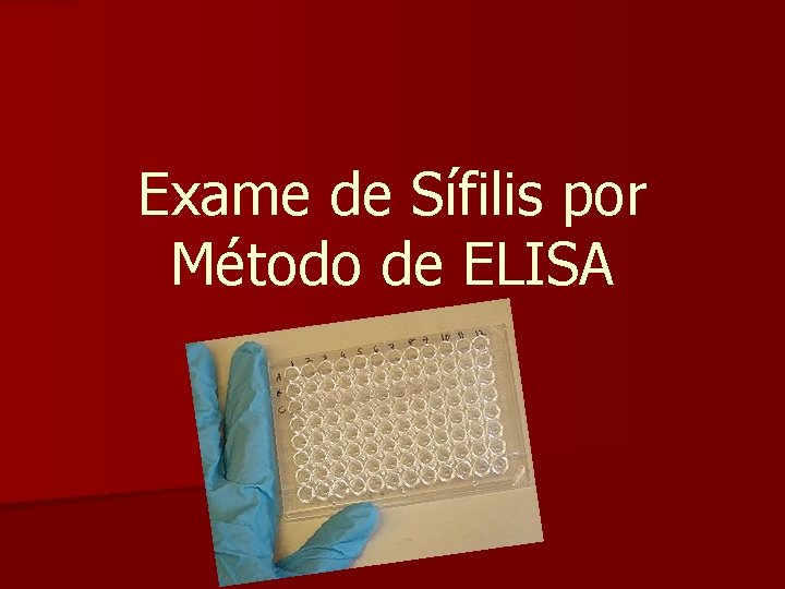 Exame de Sífilis por Método de ELISA 