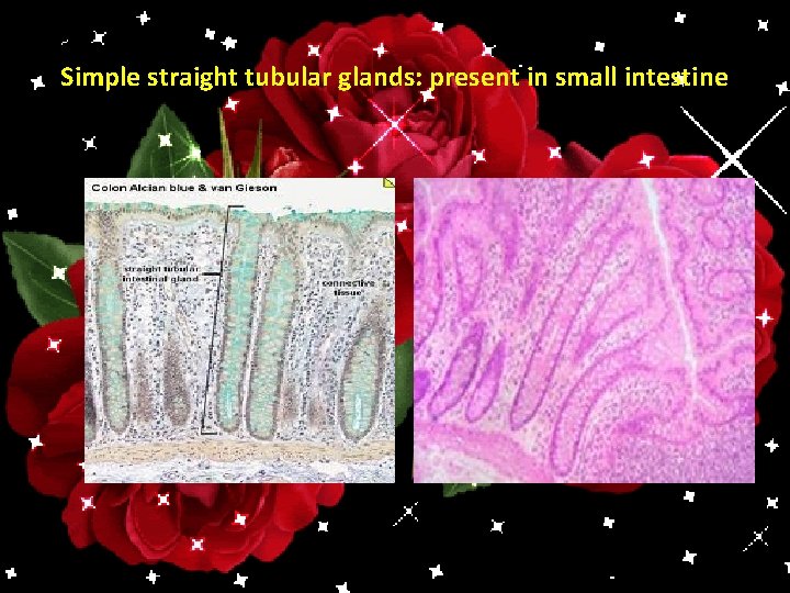 Simple straight tubular glands: present in small intestine 