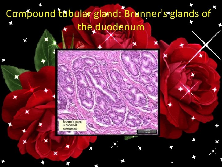 Compound tubular gland: Brunner's glands of the duodenum 