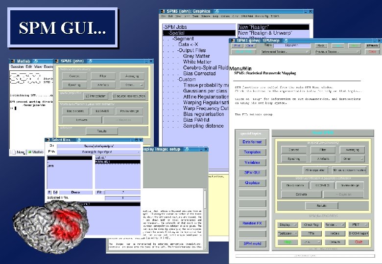 SPM GUI. . . 