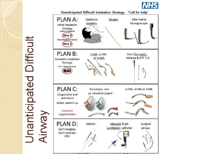 Unanticipated Difficult Airway 