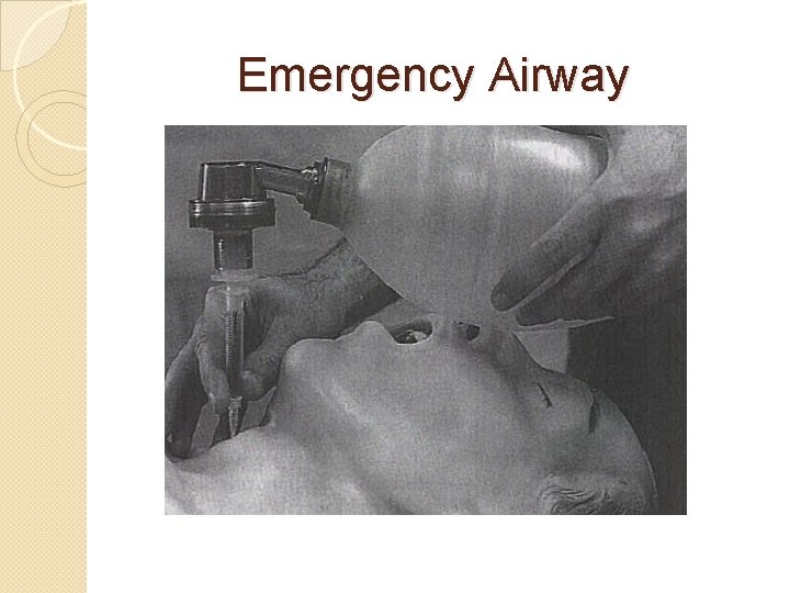  Emergency Airway 