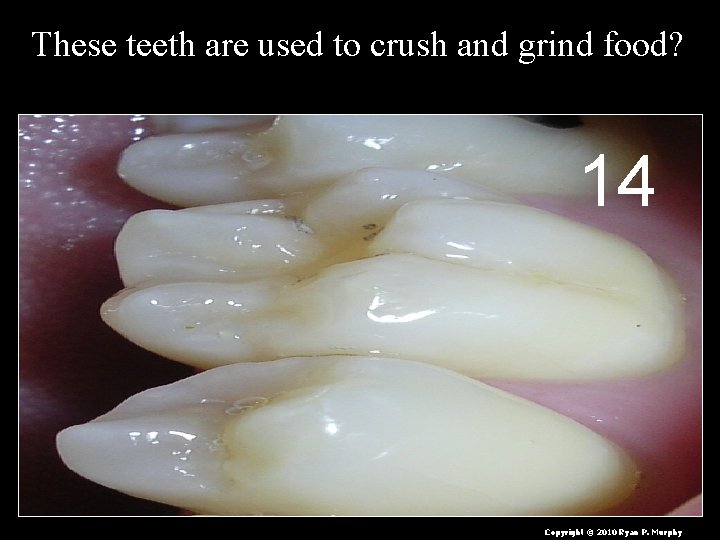 These teeth are used to crush and grind food? 14 Copyright © 2010 Ryan