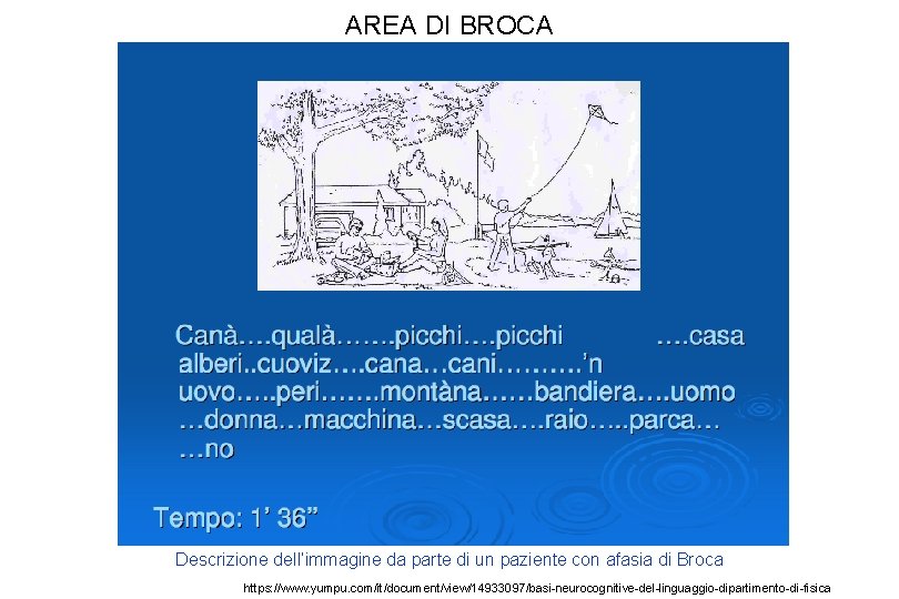 AREA DI BROCA Descrizione dell’immagine da parte di un paziente con afasia di Broca AREA DI BROCA Descrizione dell’immagine da parte di un paziente con afasia di Broca