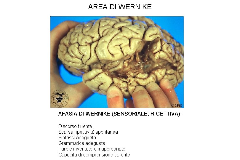 AREA DI WERNIKE AFASIA DI WERNIKE (SENSORIALE, RICETTIVA): Discorso fluente Scarsa ripetitività spontanea Sintassi AREA DI WERNIKE AFASIA DI WERNIKE (SENSORIALE, RICETTIVA): Discorso fluente Scarsa ripetitività spontanea Sintassi